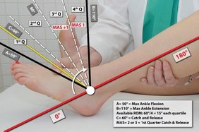 Mas Scale Table The Kozyavkin Method: Spasticity assessment. Modified Ashworth scale.